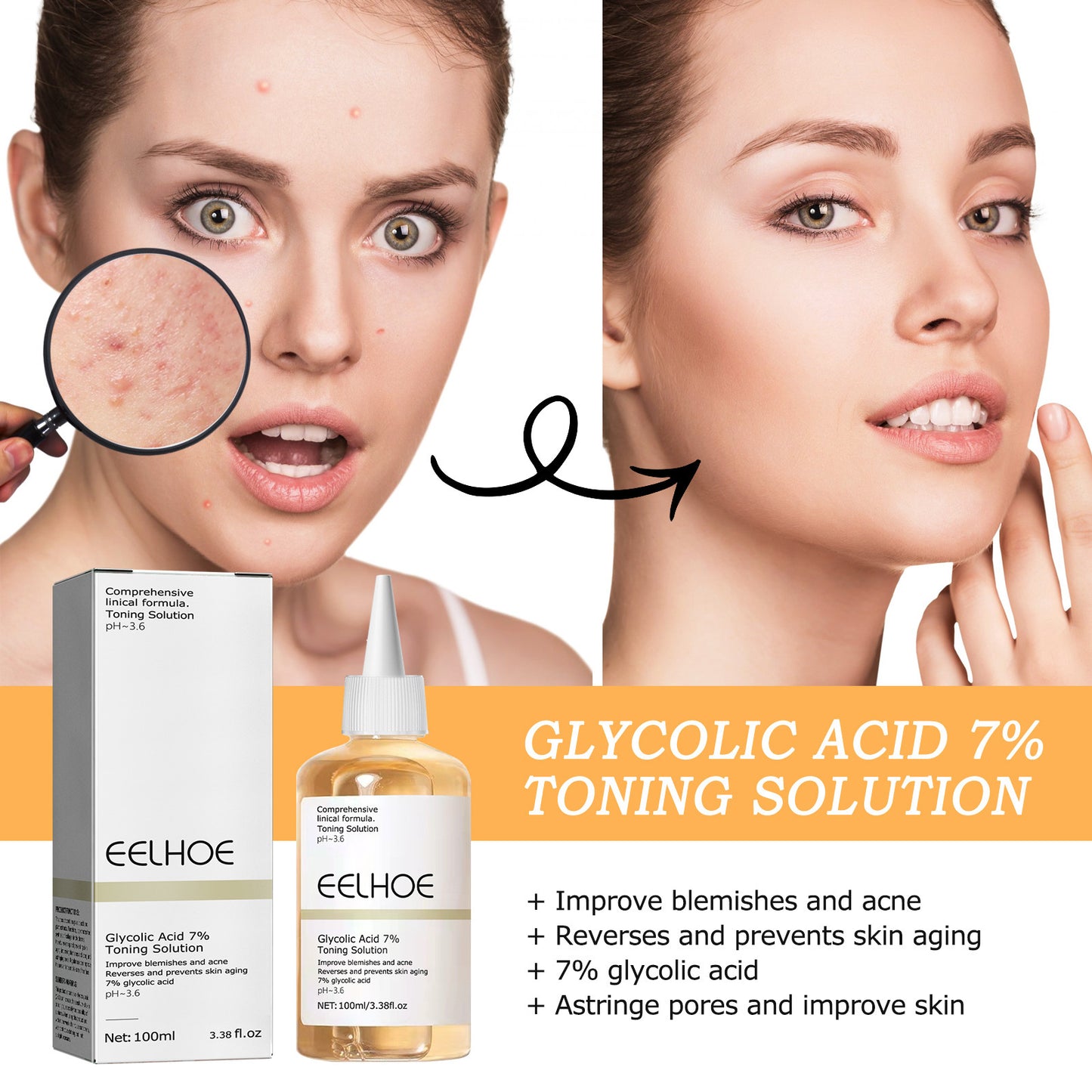 EELHOE Glycolic Acid 7 Lotion Acne Removing Closed Mouth